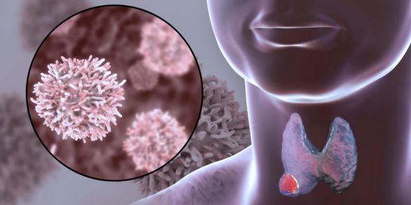 Low Thyroid Hormones