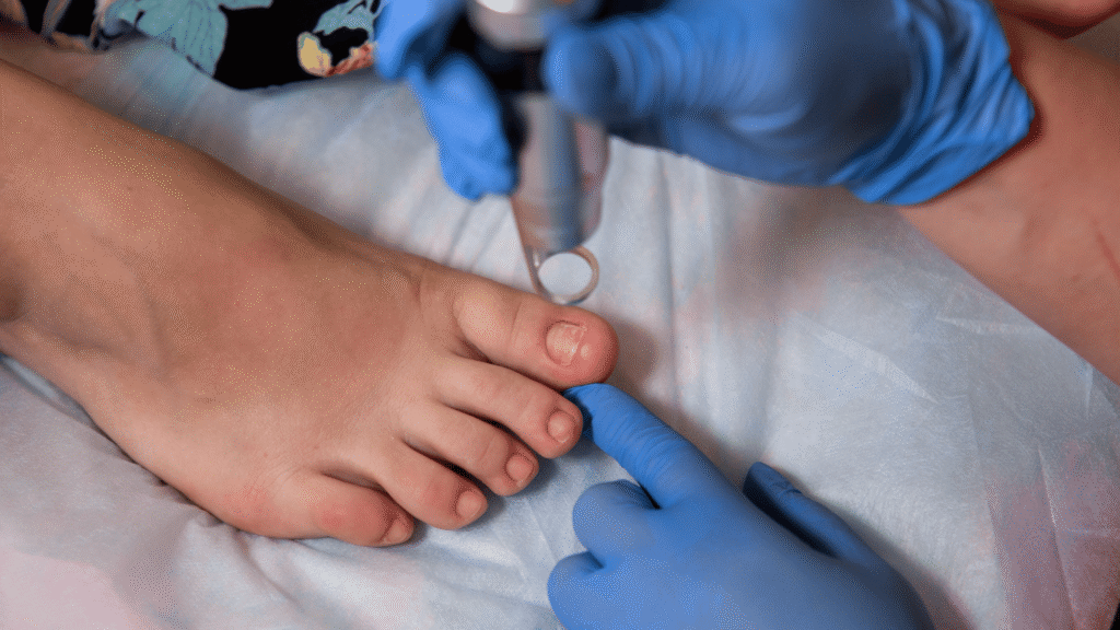 Endovenous Ablation Therapy